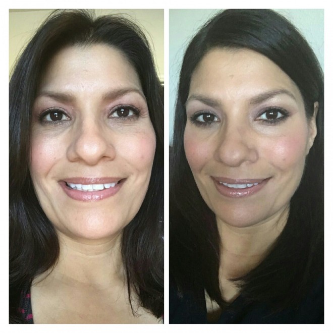 before-and-after-botox-660x660 In The Name Of Great Skin 